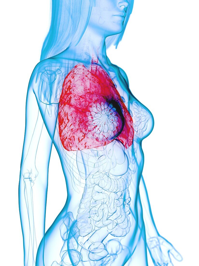 Diseased lung, illustration