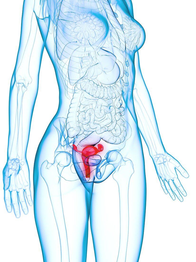 Diseased uterus, illustration