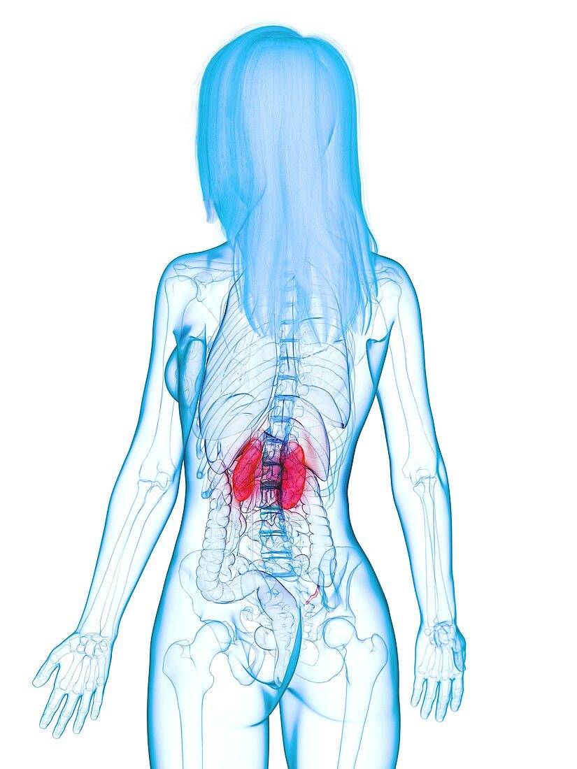Diseased kidneys, illustration