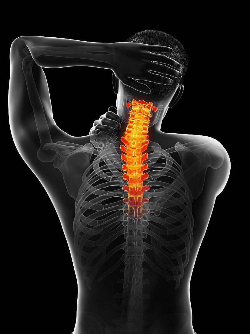 Painful neck, illustration
