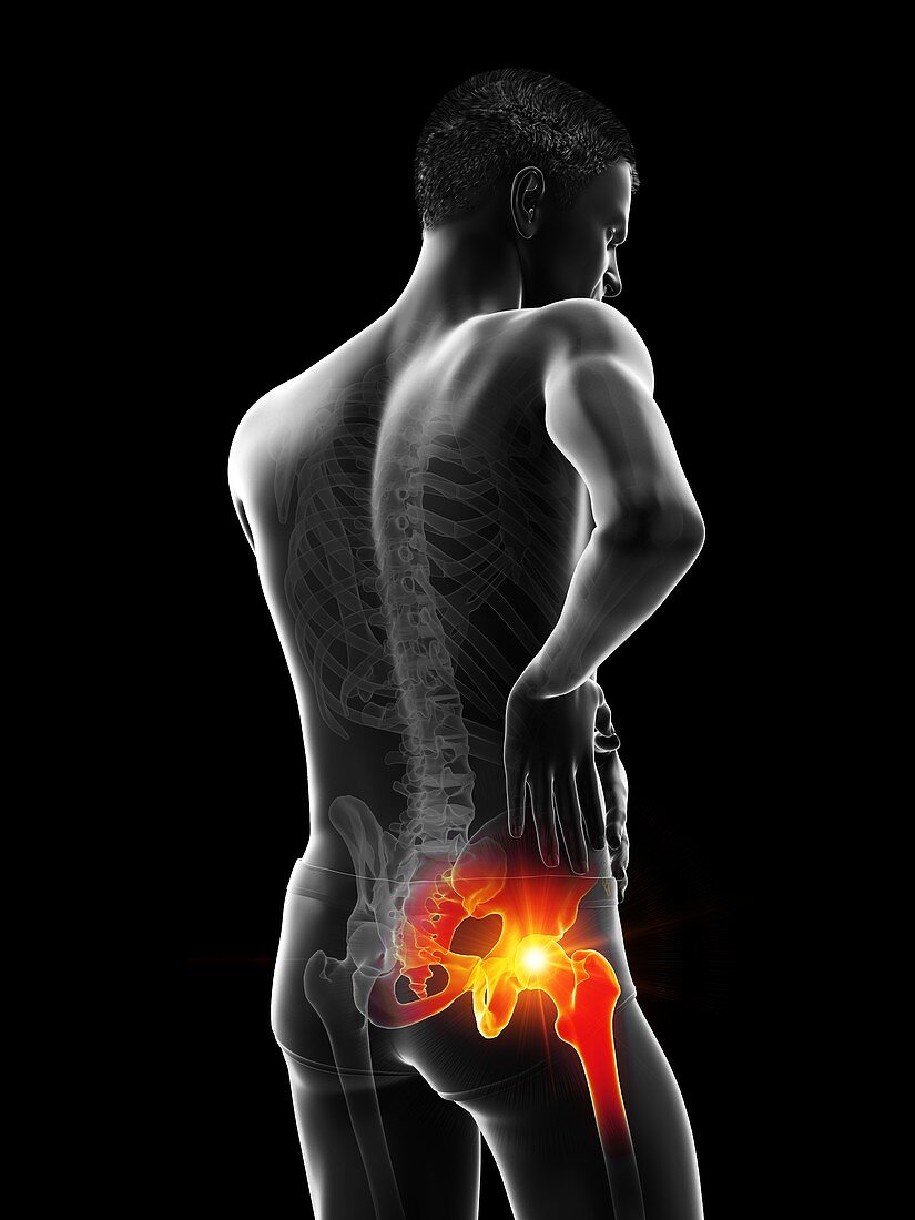 Painful shoulder joint, illustration