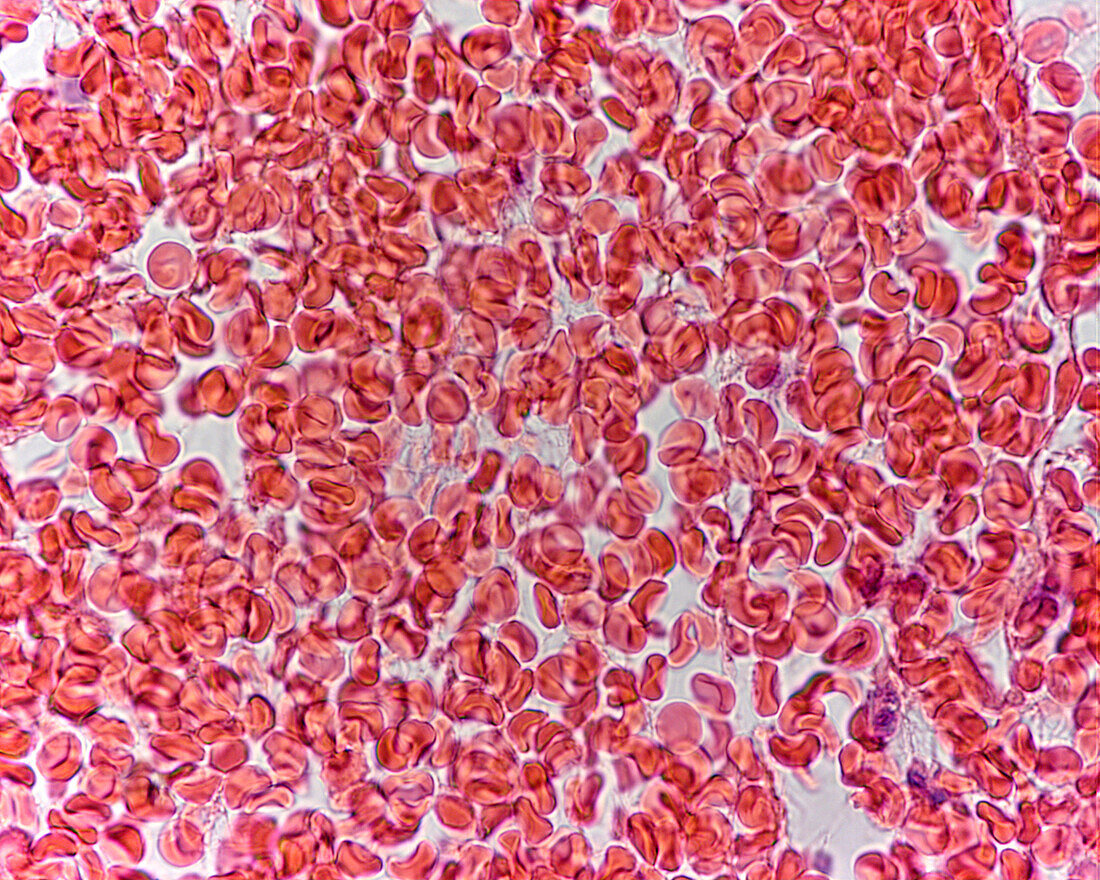 Red blood cells, light micrograph