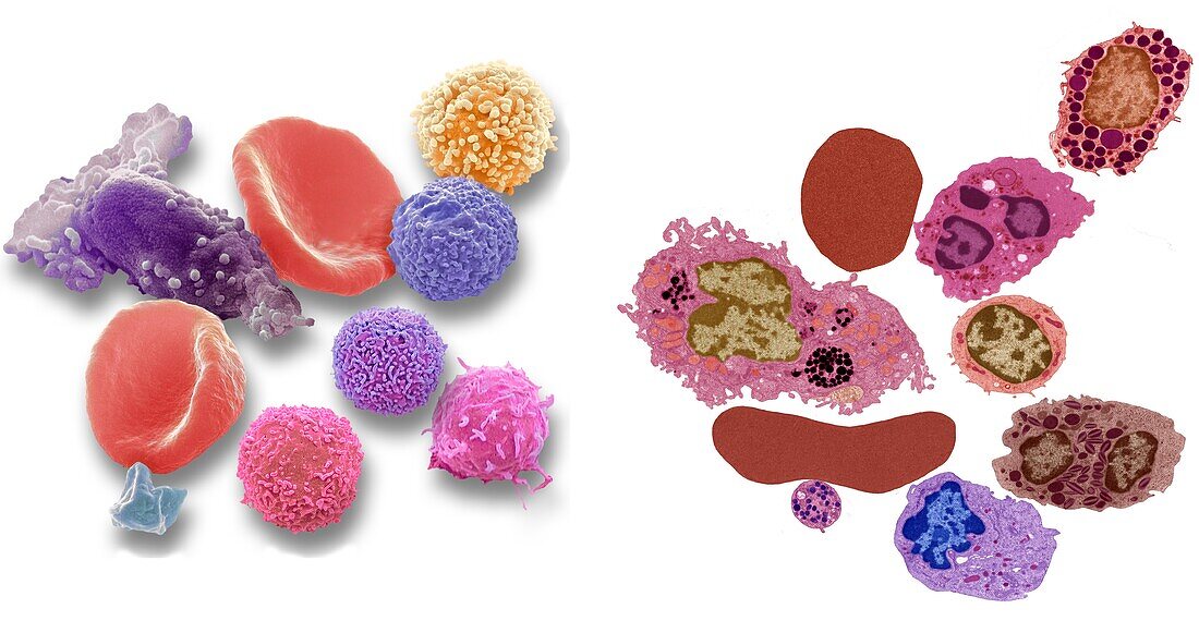 Blood cells, SEM-TEM comparison