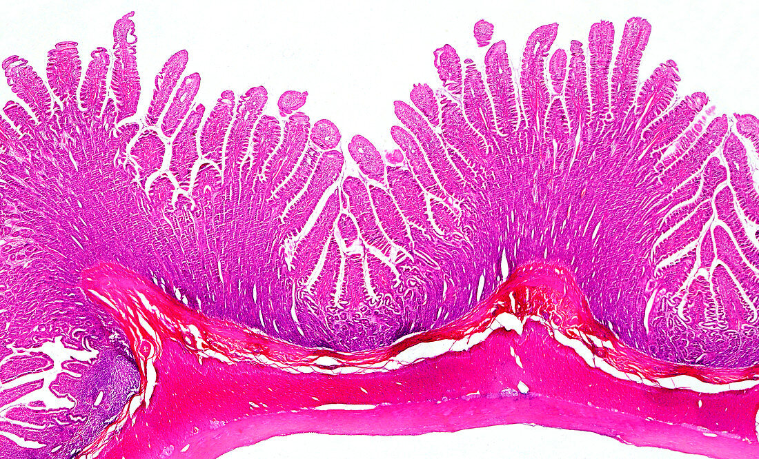 Human colon, light micrograph