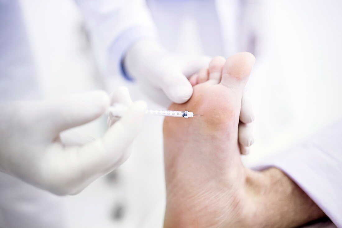 Botox injection in feet