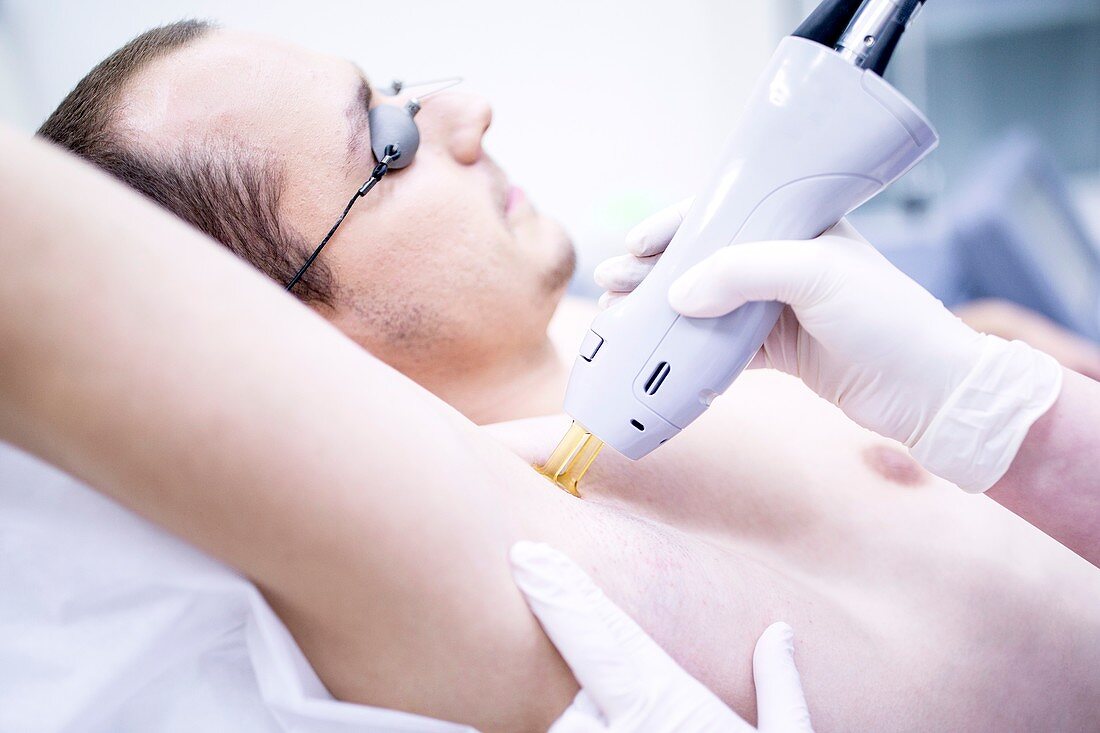 Man getting laser hair removal treatment