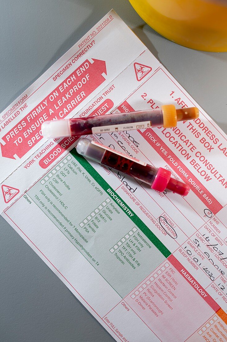 Blood test samples for analysis