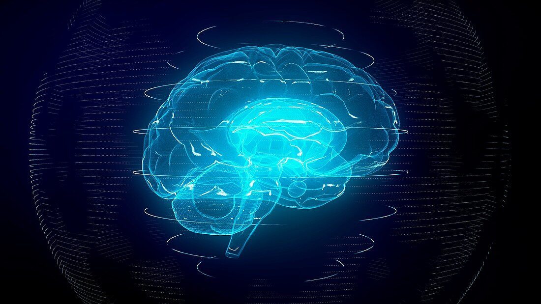 Brain scan, conceptual illustration