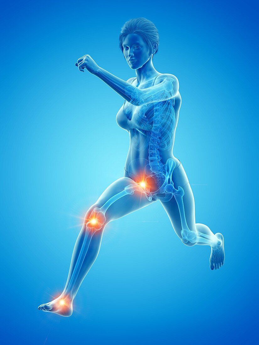 Woman with painful joints while running, illustration