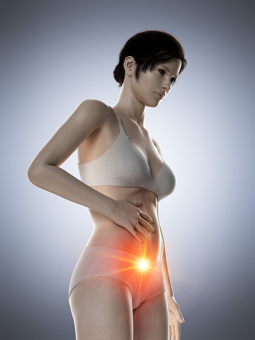 Woman with a painful abdomen, illustration