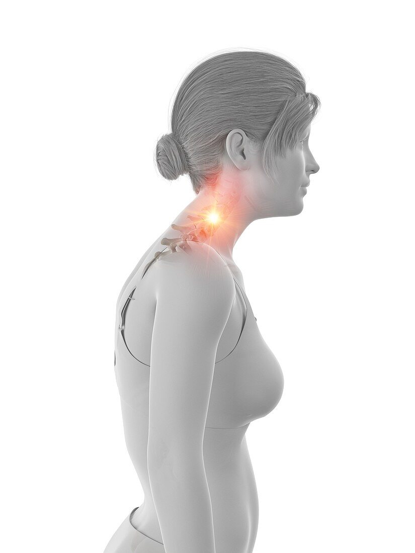 Woman with a painful neck, illustration