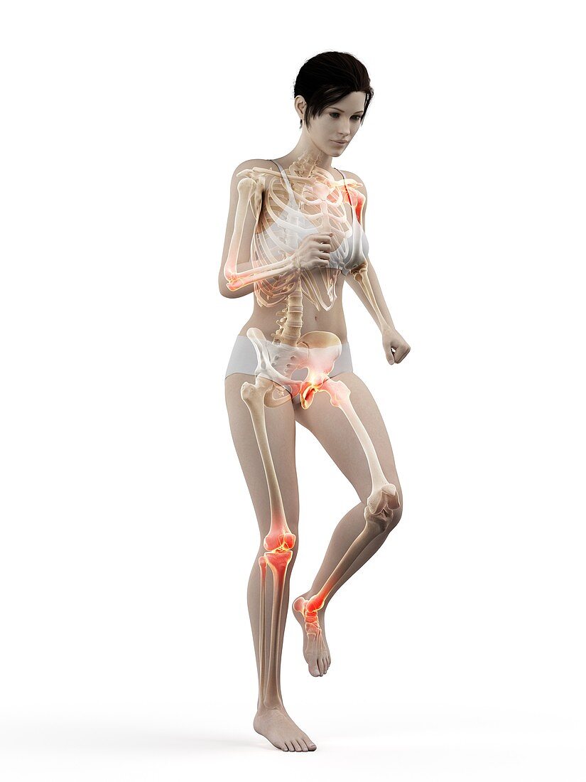 Woman with painful joints while walking, illustration