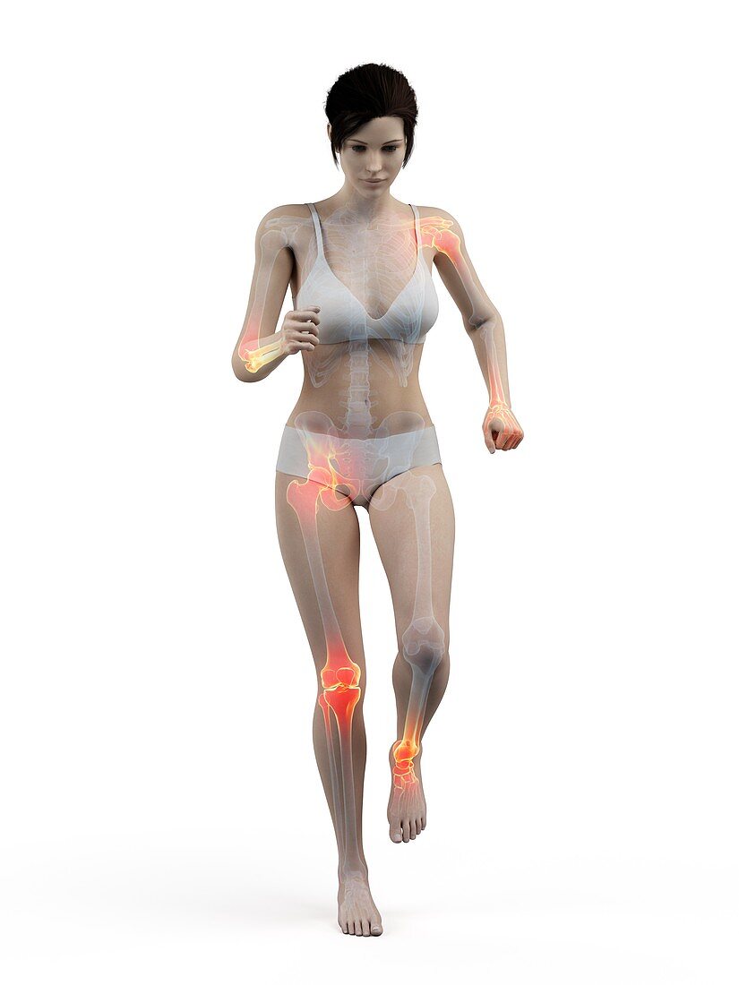 Woman with painful joints while walking, illustration