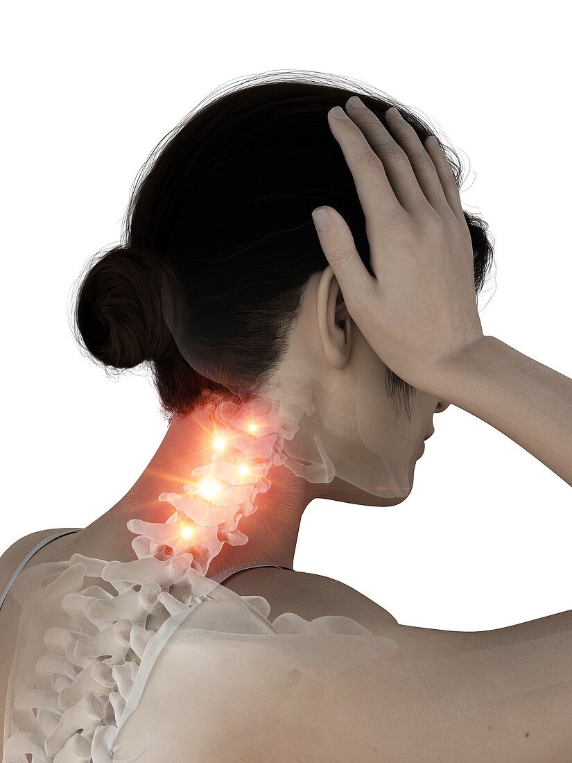 Woman with a painful neck, illustration