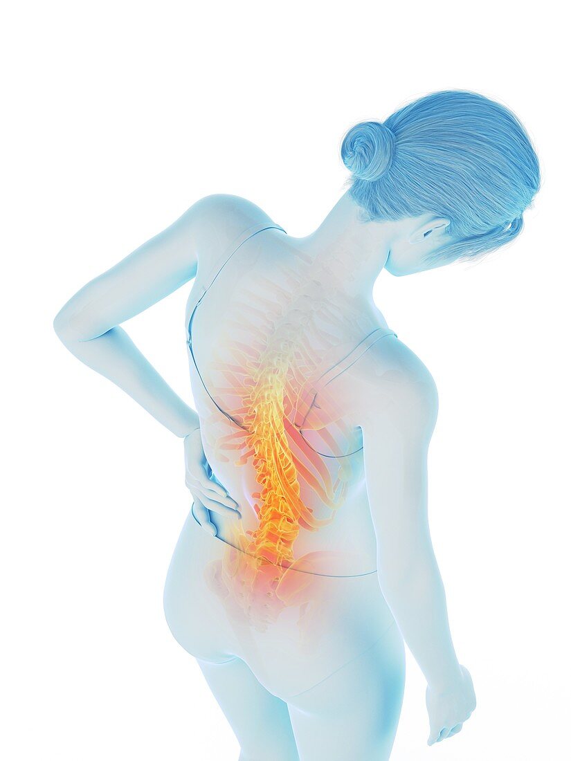 Woman with a painful back, illustration