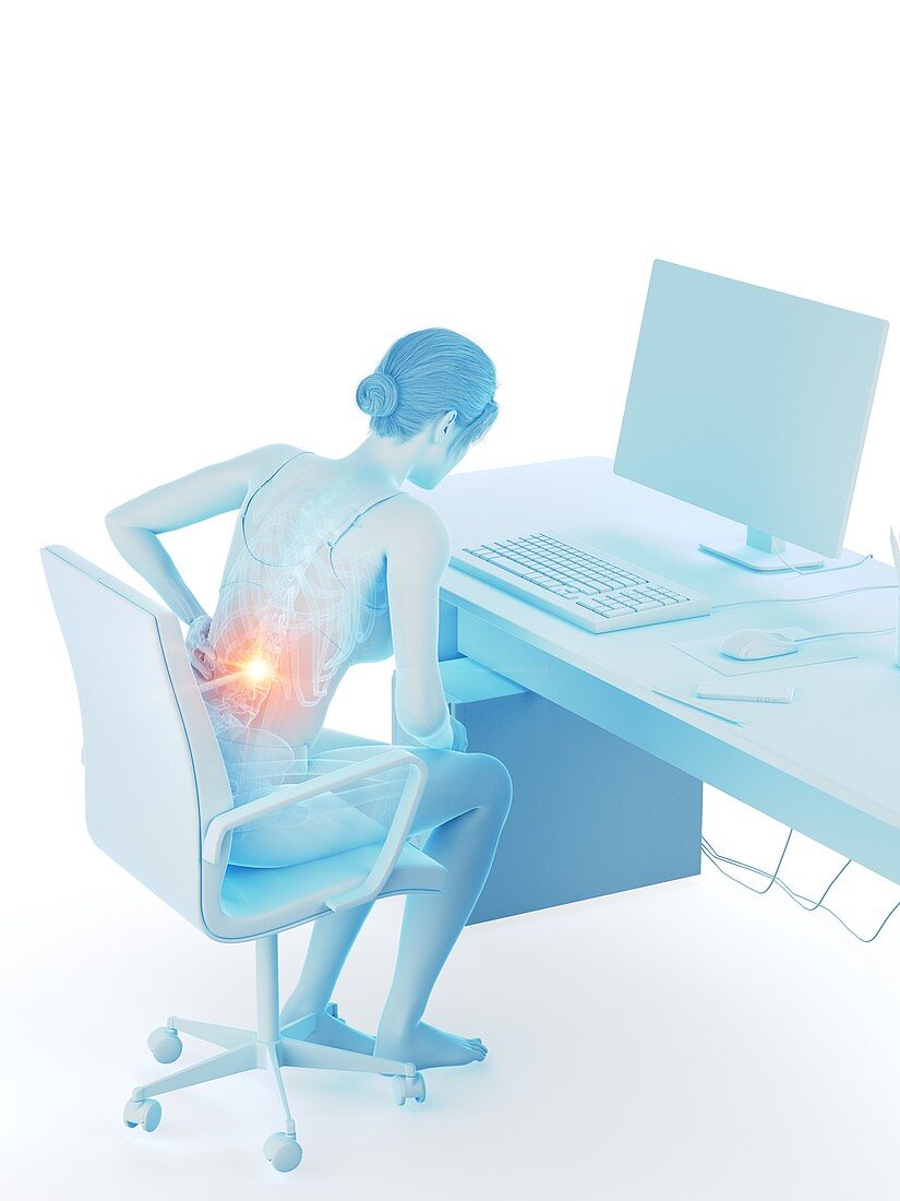 Woman with a painful back while working, illustration