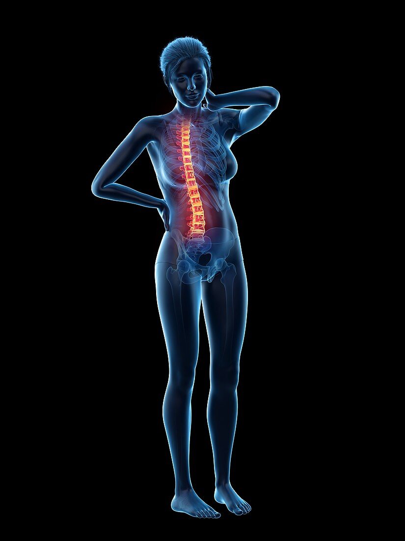 Woman with backache, illustration