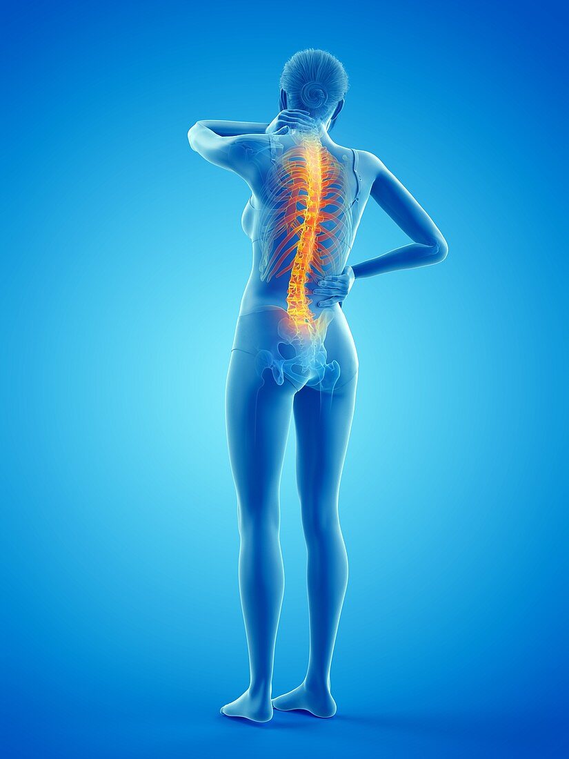 Woman with backache, illustration