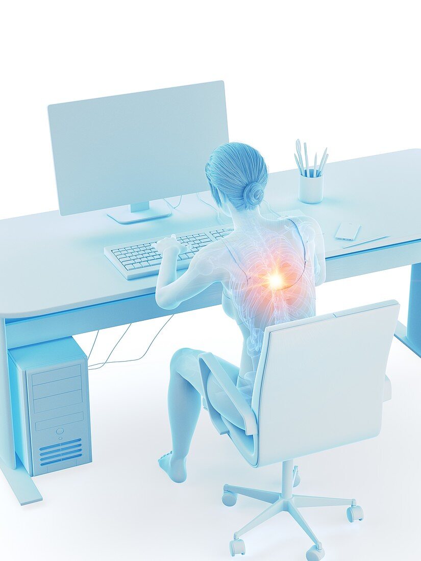 Woman with a painful back while working, illustration