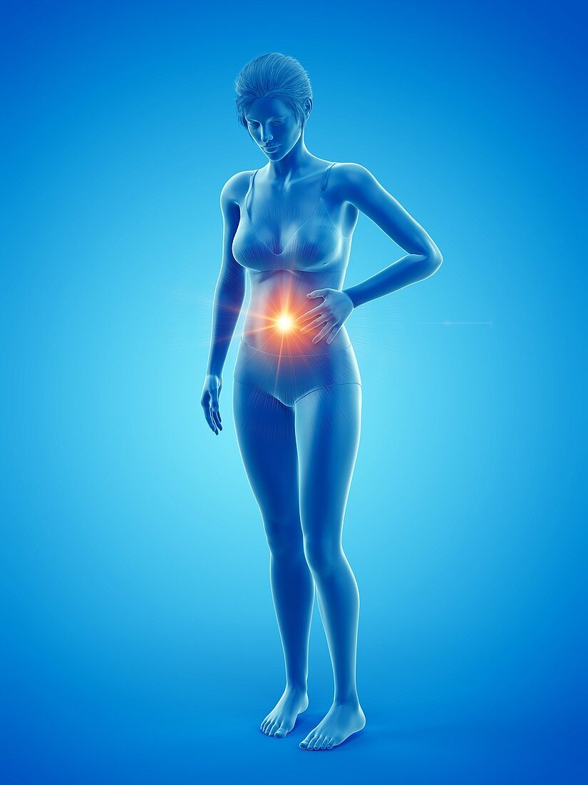 Woman with abdominal pain, illustration
