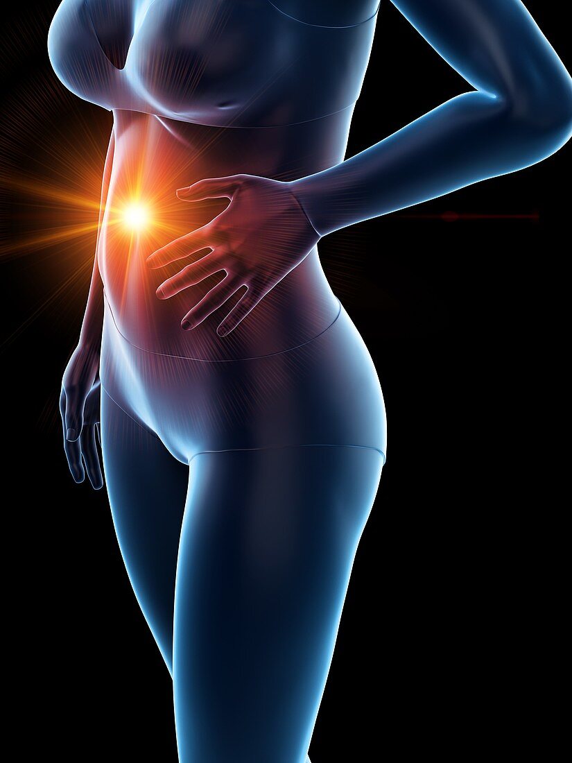 Woman with abdominal pain, illustration