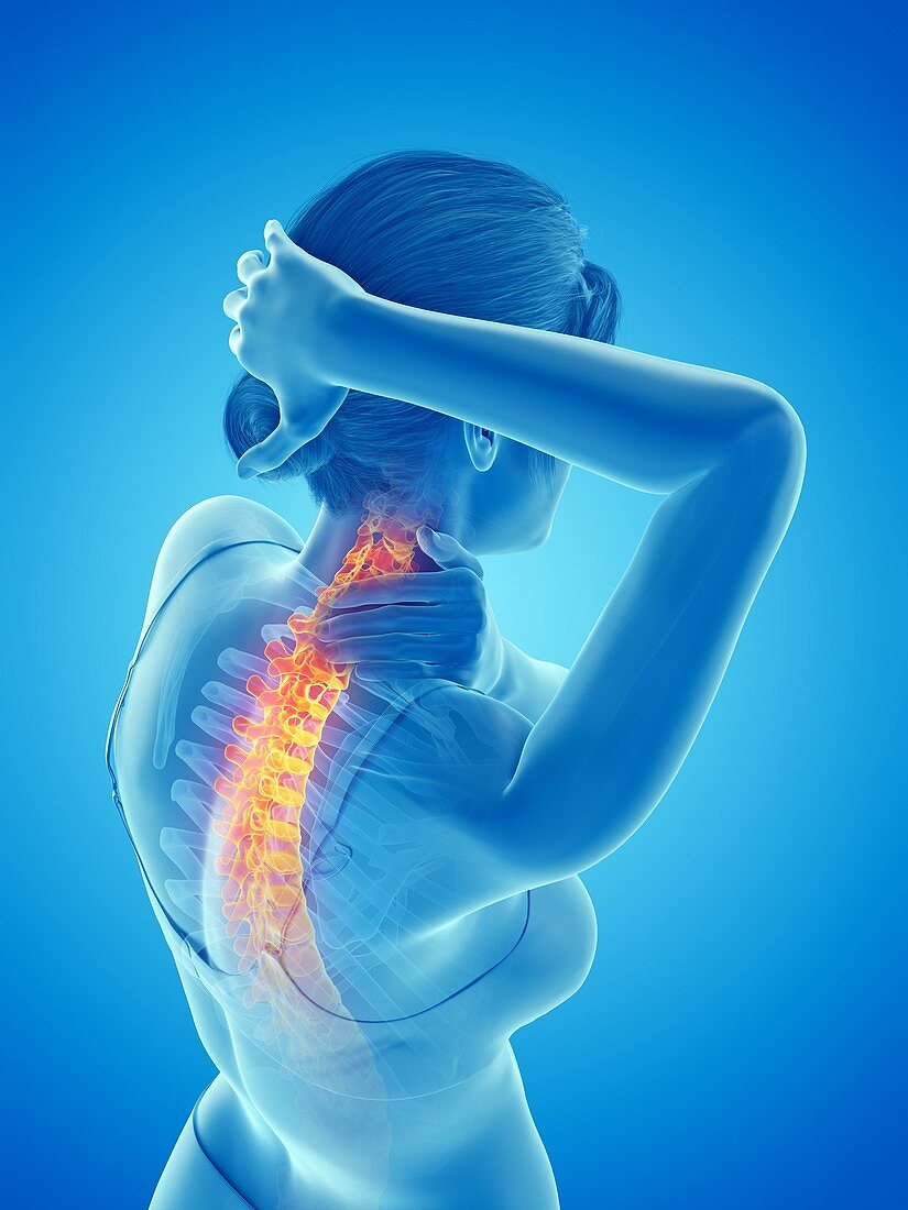 Woman with a painful neck, illustration