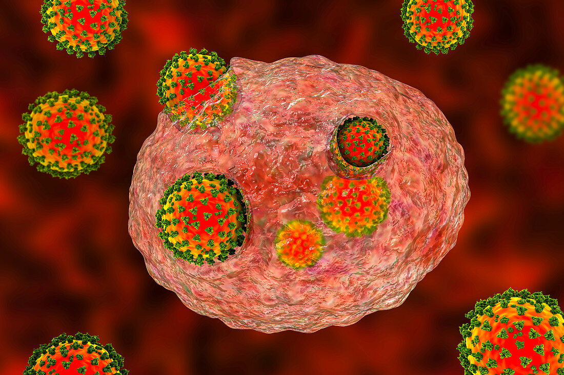 Covid-19 coronaviruses infecting human cells, illustration