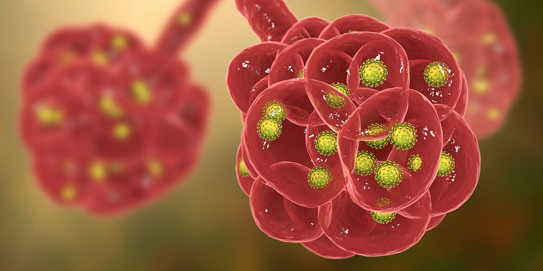 Coronavirus disease of the lungs, conceptual illustration