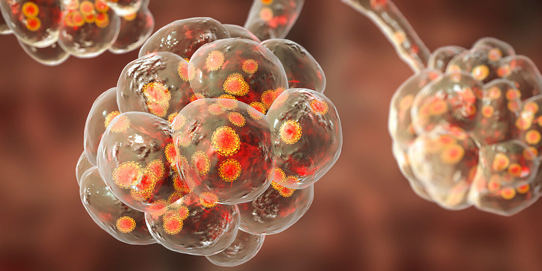 Coronavirus disease of the lungs, conceptual illustration