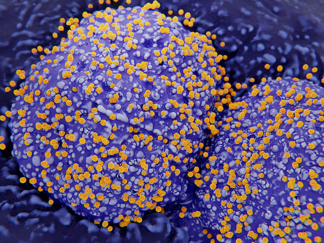 Cells infected with coronavirus, illustration