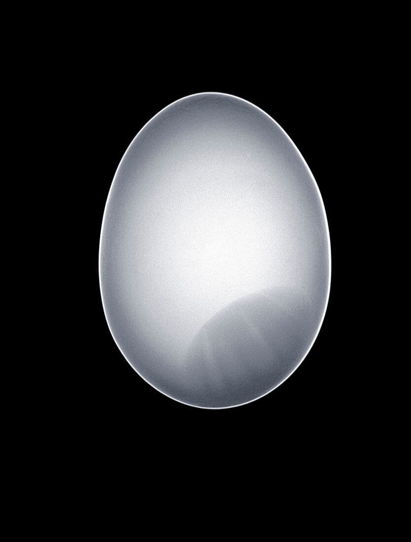 Egg, X-ray