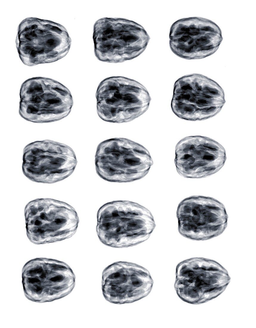 Walnuts in a group, X-ray