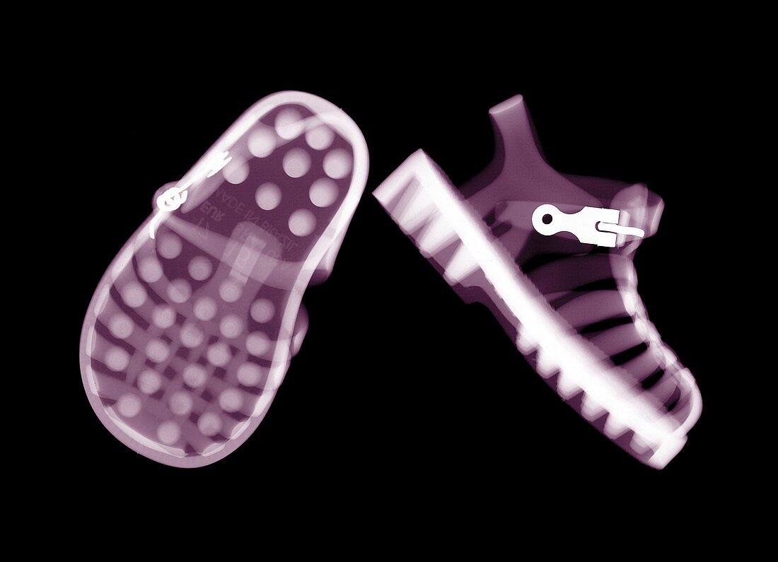 Pair of child's jelly shoes, X-ray