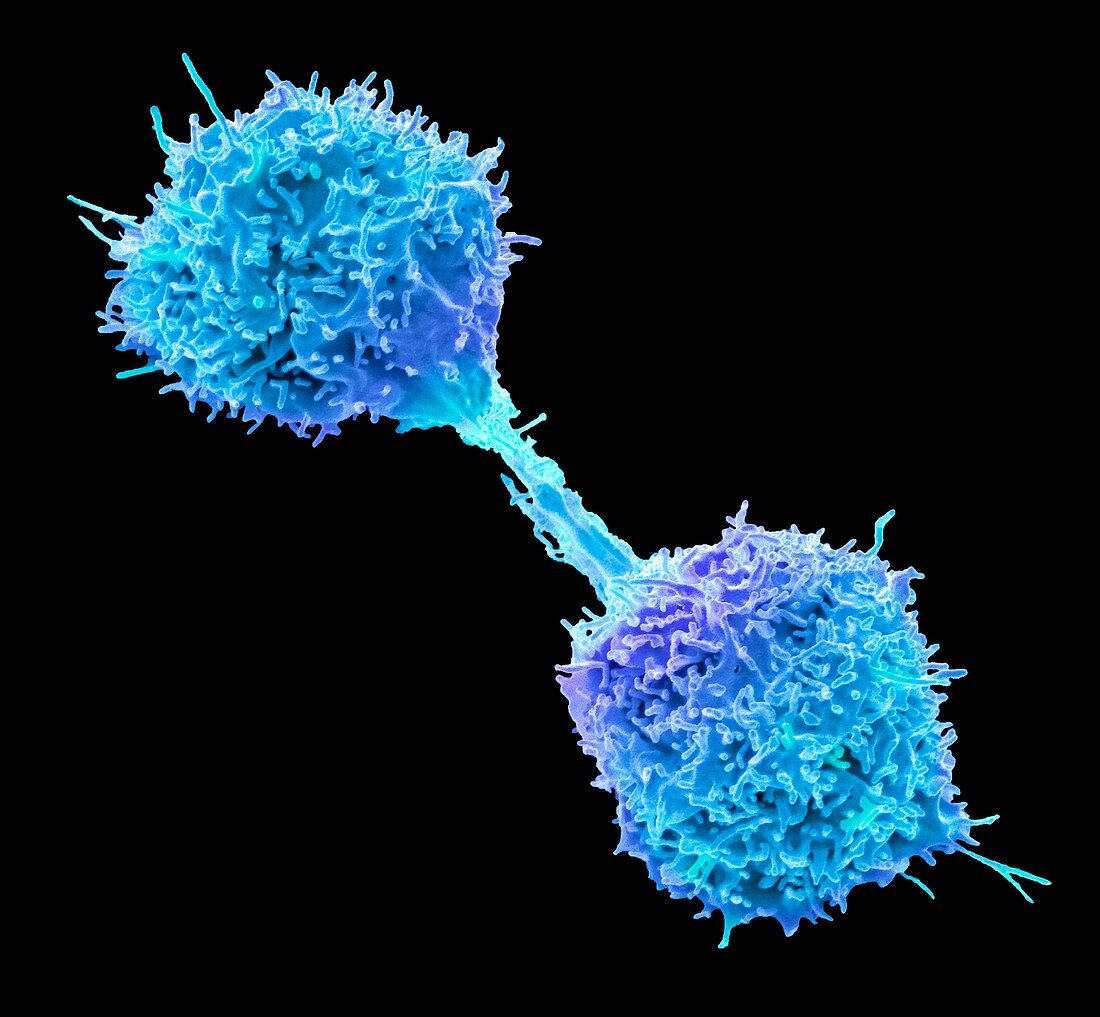 Dividing lymphoma cancer cell, SEM