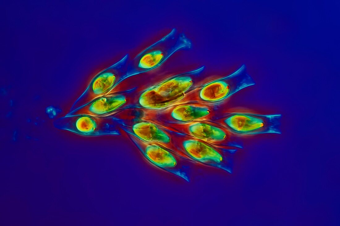 Colonial alga, Dinobryon, light micrograph