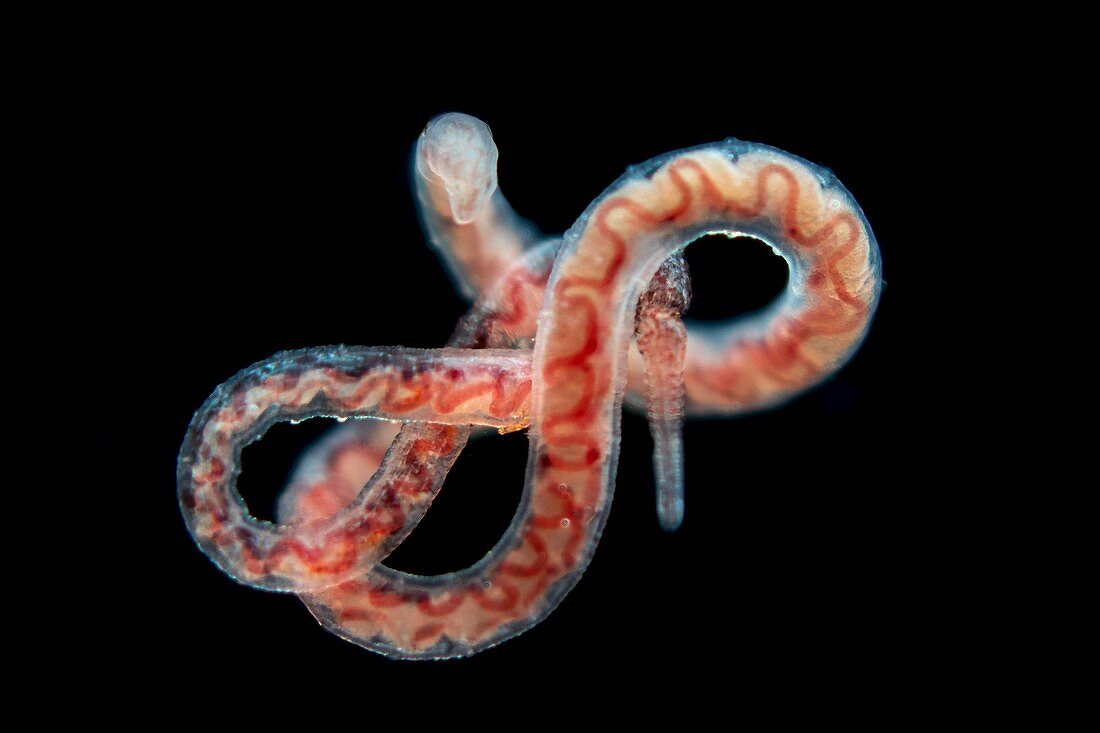 Tubifex worm, light micrograph