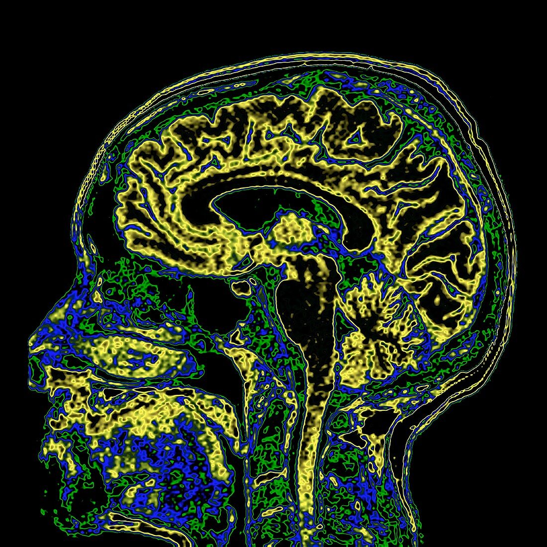 Human head and brain, sagittal MRI scan