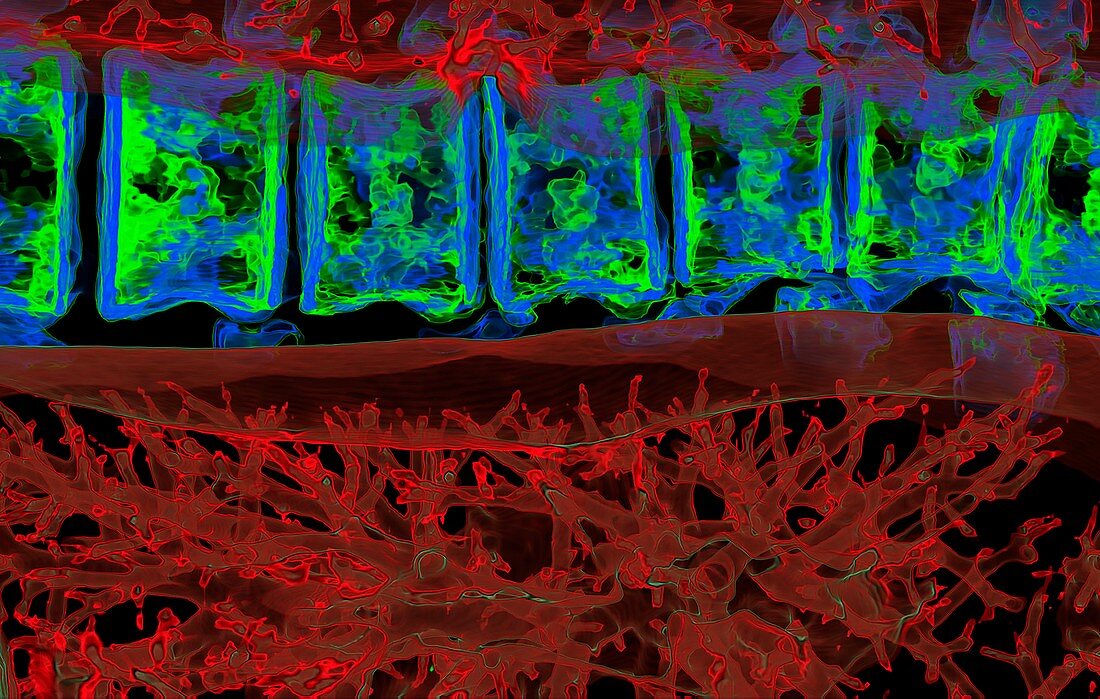 Lung airways and backbone, 3D CT scan