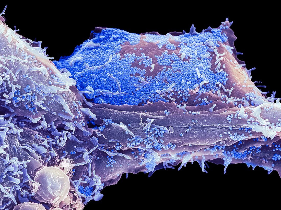 Cell infected with herpes virus, SEM
