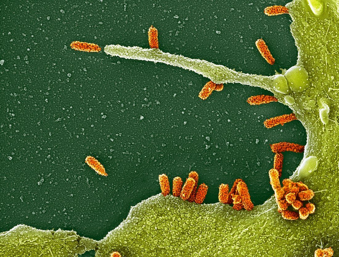 Lung cells infected with H1N1 flu virus, SEM