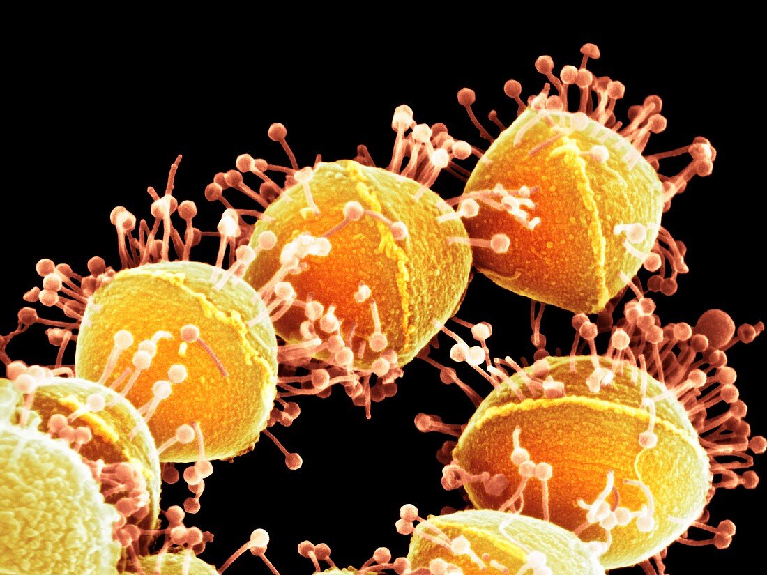 Bacteriophages attacking Streptococcus bacteria, SEM