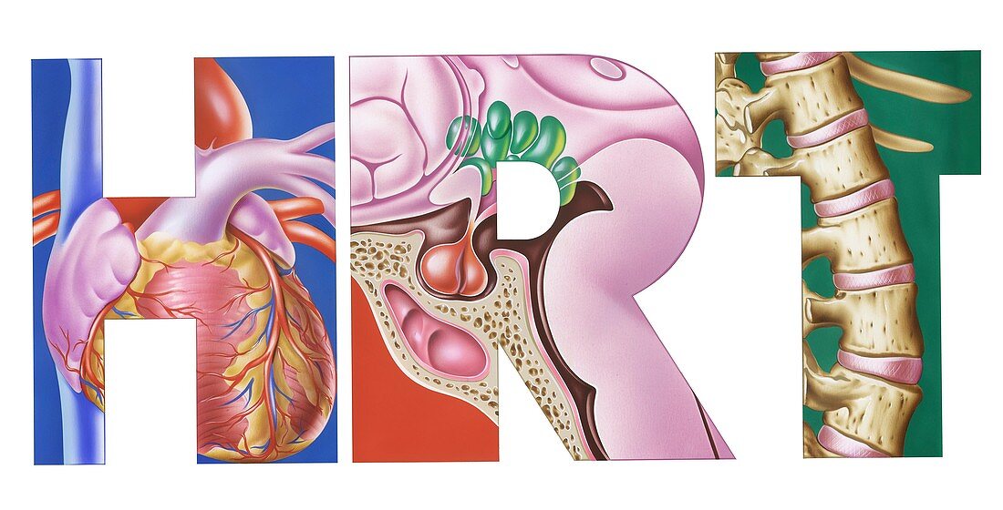 Effects of hormone replacement therapy, illustration