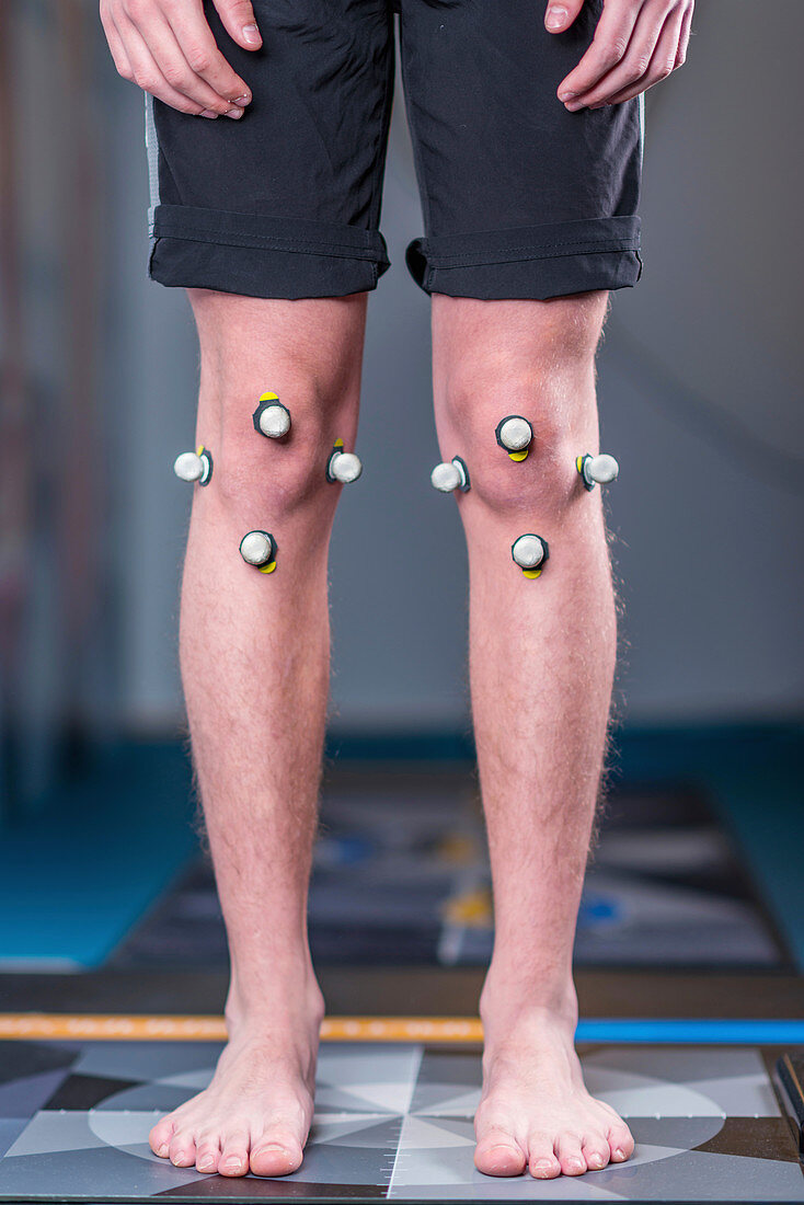 Markers for posture analysis