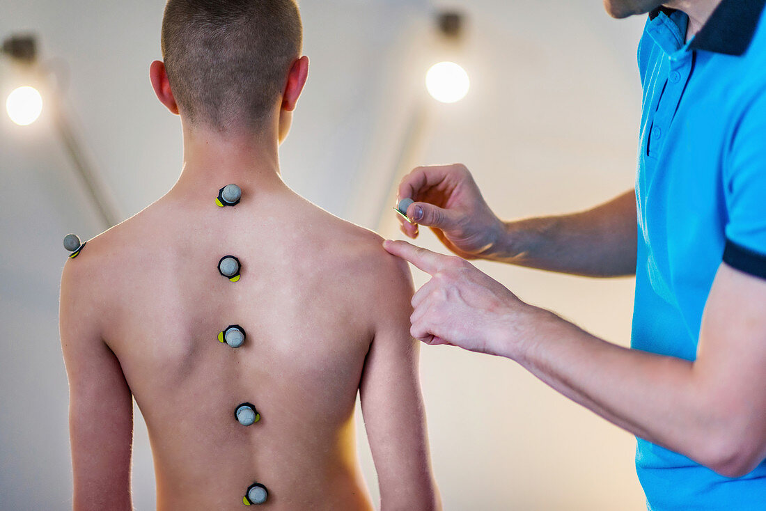 Placing markers for posture analysis
