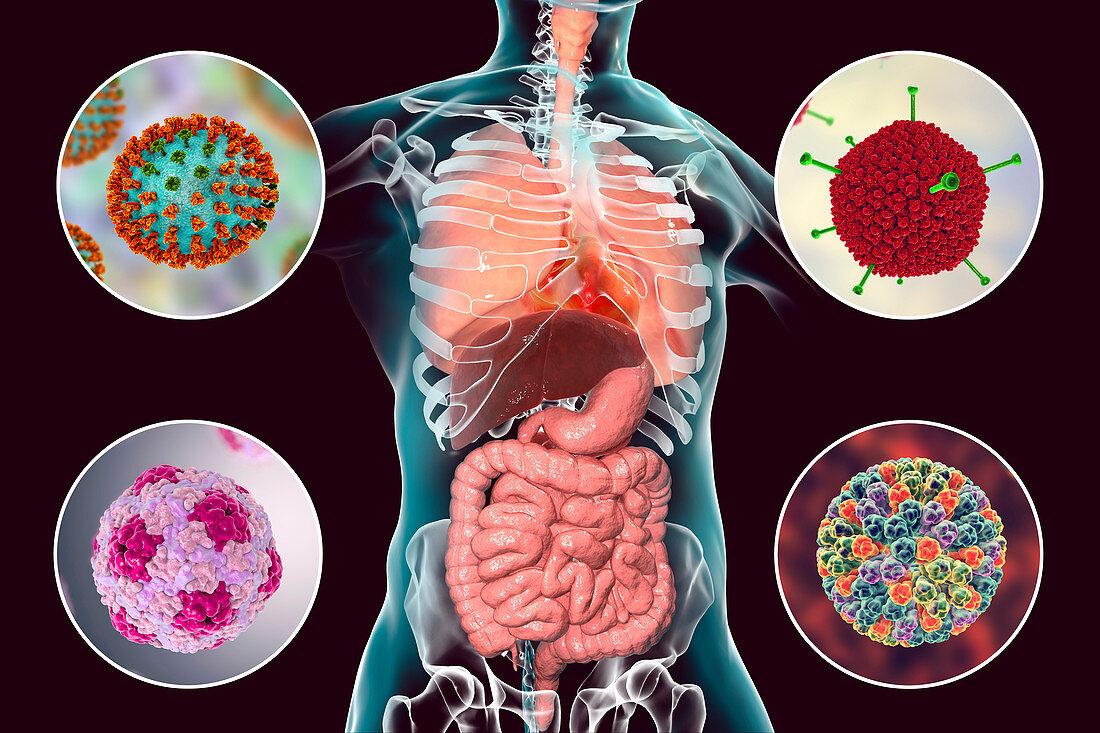 Viral respiratory and enteric infections, illustration