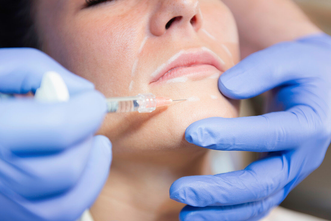 Woman having hyaluronic acid injections