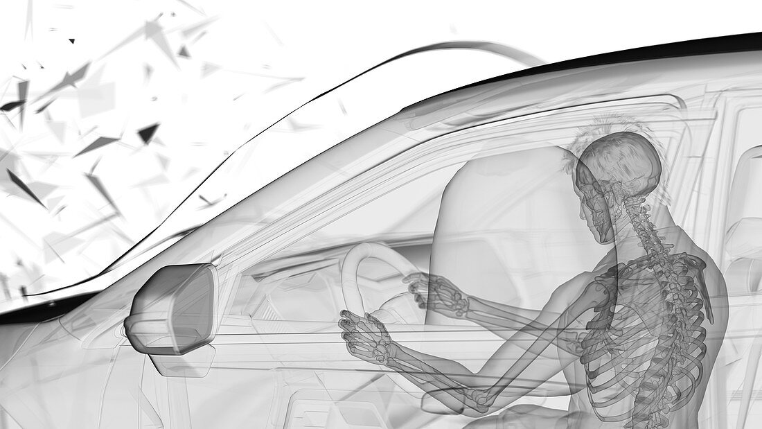 Airbag deployed in car crash, illustration