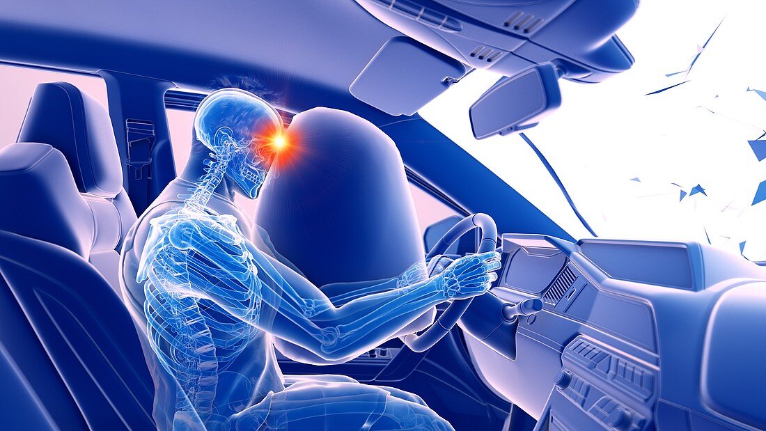 Airbag deployed in car crash, illustration