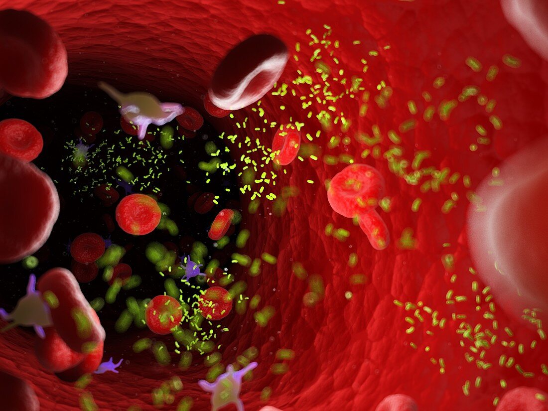 Bacteria in a blood vessel, illustration