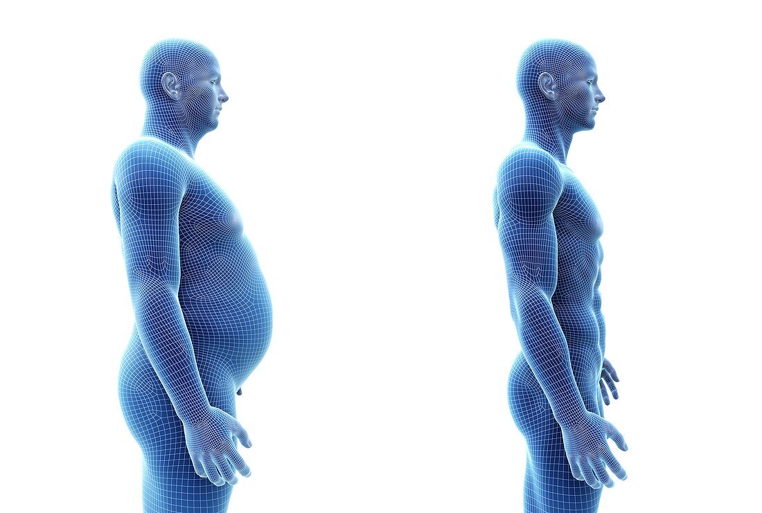 Comparison of a fit and obese male, illustration